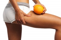 Orangenhaut / Cellulite  - Nur Bewegung und Ernährung hilft